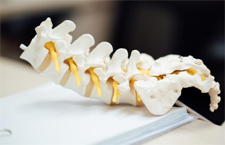 MS Tanısı/Takibi/Tedavisi